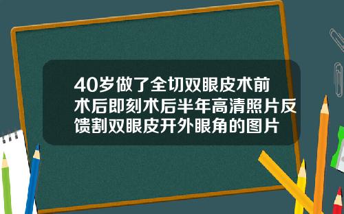40岁做了全切双眼皮术前术后即刻术后半年高清照片反馈割双眼皮开外眼角的图片