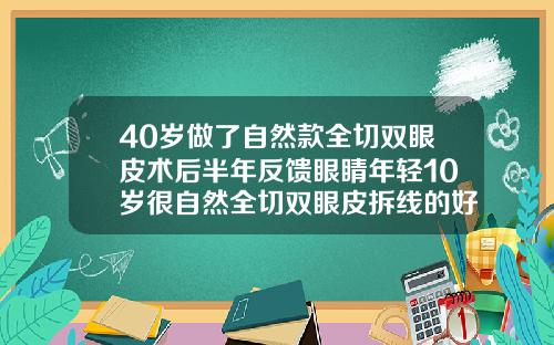 40岁做了自然款全切双眼皮术后半年反馈眼睛年轻10岁很自然全切双眼皮拆线的好还是不拆线的好