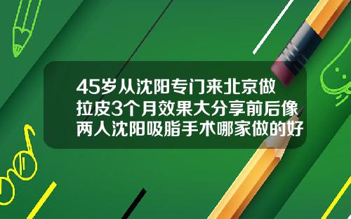 45岁从沈阳专门来北京做拉皮3个月效果大分享前后像两人沈阳吸脂手术哪家做的好点