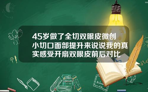45岁做了全切双眼皮微创小切口面部提升来说说我的真实感受开扇双眼皮前后对比