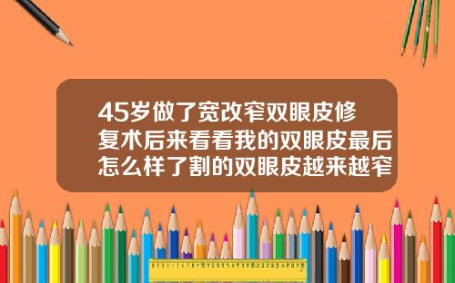 45岁做了宽改窄双眼皮修复术后来看看我的双眼皮最后怎么样了割的双眼皮越来越窄怎么办