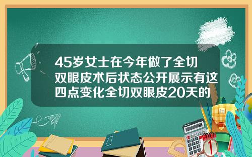 45岁女士在今年做了全切双眼皮术后状态公开展示有这四点变化全切双眼皮20天的状态