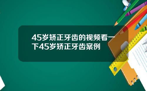45岁矫正牙齿的视频看一下45岁矫正牙齿案例