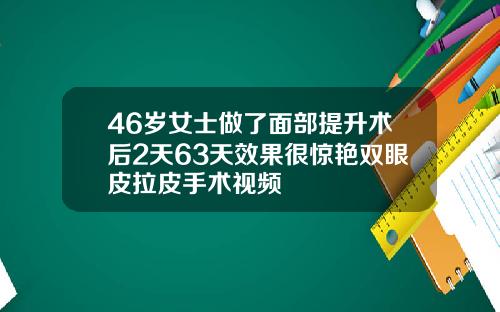 46岁女士做了面部提升术后2天63天效果很惊艳双眼皮拉皮手术视频
