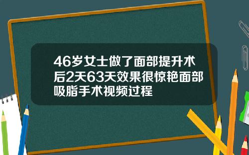 46岁女士做了面部提升术后2天63天效果很惊艳面部吸脂手术视频过程