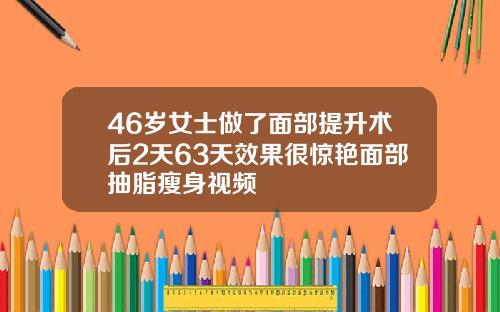 46岁女士做了面部提升术后2天63天效果很惊艳面部抽脂瘦身视频
