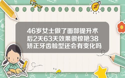 46岁女士做了面部提升术后2天63天效果很惊艳38矫正牙齿脸型还会有变化吗