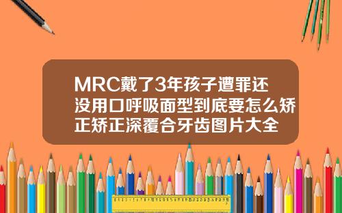 MRC戴了3年孩子遭罪还没用口呼吸面型到底要怎么矫正矫正深覆合牙齿图片大全