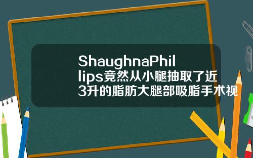 ShaughnaPhillips竟然从小腿抽取了近3升的脂肪大腿部吸脂手术视频