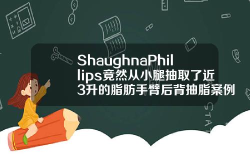 ShaughnaPhillips竟然从小腿抽取了近3升的脂肪手臂后背抽脂案例效果视频