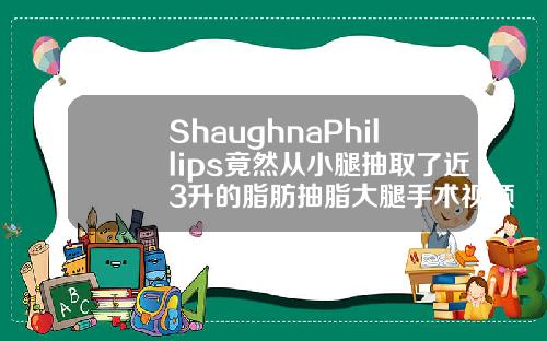 ShaughnaPhillips竟然从小腿抽取了近3升的脂肪抽脂大腿手术视频全过程