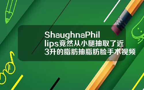 ShaughnaPhillips竟然从小腿抽取了近3升的脂肪抽脂肪脸手术视频