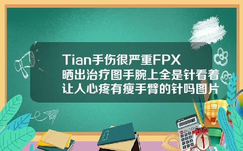 Tian手伤很严重FPX晒出治疗图手腕上全是针看着让人心疼有瘦手臂的针吗图片