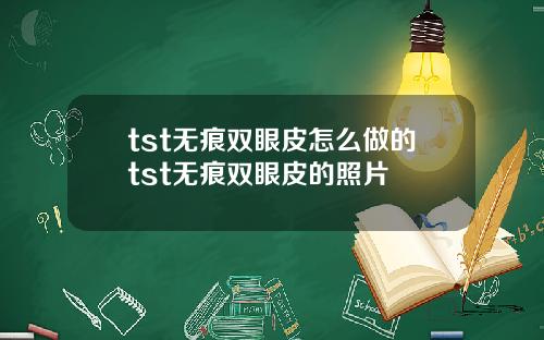 tst无痕双眼皮怎么做的tst无痕双眼皮的照片