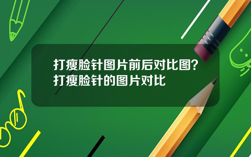 打瘦脸针图片前后对比图？打瘦脸针的图片对比